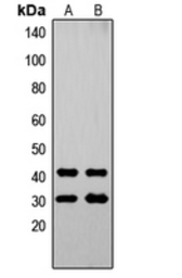 Anti-OVOL1 antibody used in Western Blot (WB). GTX55272