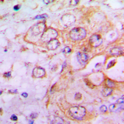 Anti-PFKFB2 antibody used in IHC (Paraffin sections) (IHC-P). GTX55273
