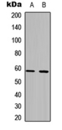 Anti-PFKFB2 antibody used in Western Blot (WB). GTX55273
