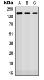 Anti-ROBO2 antibody used in Western Blot (WB). GTX55278