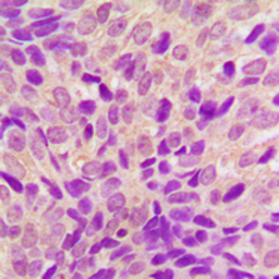 Anti-RSK4 antibody used in IHC (Paraffin sections) (IHC-P). GTX55279