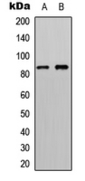 Anti-RSK4 antibody used in Western Blot (WB). GTX55279