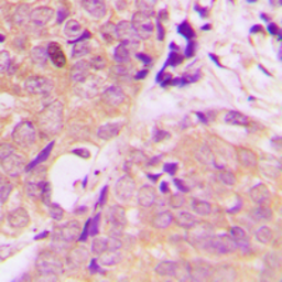 Anti-CARKL antibody used in IHC (Paraffin sections) (IHC-P). GTX55280