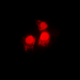 Anti-SIAH2 antibody used in Immunocytochemistry/ Immunofluorescence (ICC/IF). GTX55281