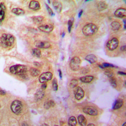Anti-SIAH2 antibody used in IHC (Paraffin sections) (IHC-P). GTX55281