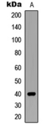 Anti-SIAH2 antibody used in Western Blot (WB). GTX55281