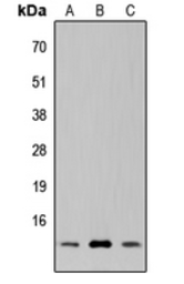 Anti-SUPT4H1 antibody used in Western Blot (WB). GTX55283