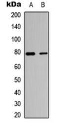 Anti-TBX3 antibody used in Western Blot (WB). GTX55284