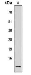 Anti-TUSC2 antibody used in Western Blot (WB). GTX55285