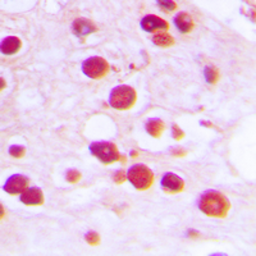 Anti-ZNF232 antibody used in IHC (Paraffin sections) (IHC-P). GTX55286