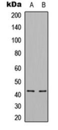 Anti-CDKL1 antibody used in Western Blot (WB). GTX55287