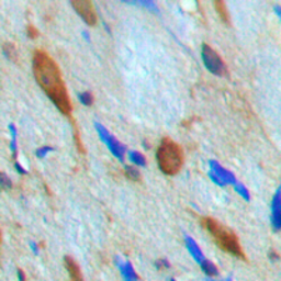 Anti-MNK1 antibody used in IHC (Paraffin sections) (IHC-P). GTX55289