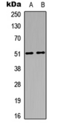 Anti-MNK1 antibody used in Western Blot (WB). GTX55289