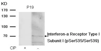 Anti-IFNAR1 (phospho Ser535/Ser539) antibody used in Western Blot (WB). GTX55295