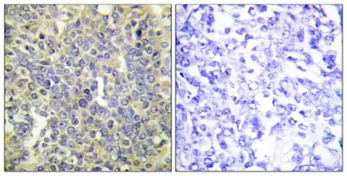 Anti-Caspase 9 (phospho Thr125) antibody used in IHC (Paraffin sections) (IHC-P). GTX55305