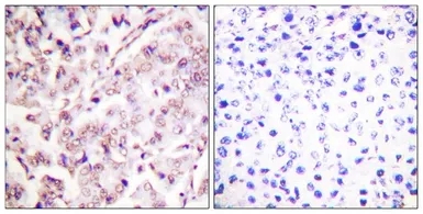 Anti-ETS1 (phospho Thr38) antibody used in IHC (Paraffin sections) (IHC-P). GTX55307