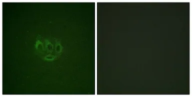 Anti-ACK1 (phospho Tyr284) antibody used in Immunocytochemistry/ Immunofluorescence (ICC/IF). GTX55310