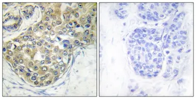 Anti-ACK1 (phospho Tyr284) antibody used in IHC (Paraffin sections) (IHC-P). GTX55310