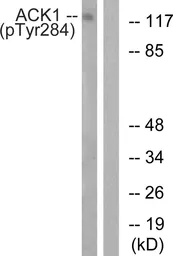Anti-ACK1 (phospho Tyr284) antibody used in Western Blot (WB). GTX55310