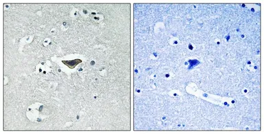 Anti-RASGRF1 (phospho Ser916) antibody used in IHC (Paraffin sections) (IHC-P). GTX55312