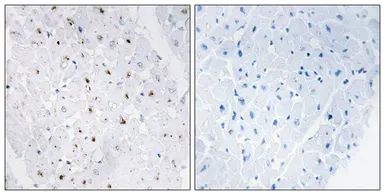 Anti-BLM (phospho Thr99) antibody used in IHC (Paraffin sections) (IHC-P). GTX55314