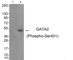 Anti-GATA2 (phospho Ser401) antibody used in Western Blot (WB). GTX55317