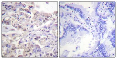 Anti-AUF1 (phospho Ser83) antibody used in IHC (Paraffin sections) (IHC-P). GTX55319