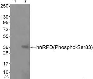 Anti-AUF1 (phospho Ser83) antibody used in Western Blot (WB). GTX55319