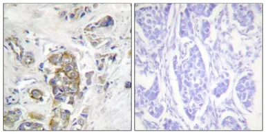 Anti-Integrin beta 4 (phospho Tyr1510) antibody used in IHC (Paraffin sections) (IHC-P). GTX55321