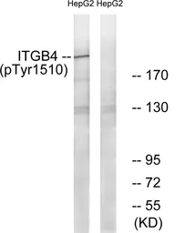 Anti-Integrin beta 4 (phospho Tyr1510) antibody used in Western Blot (WB). GTX55321