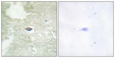 Anti-TGF beta Receptor 2 (phospho Ser225/250) antibody used in IHC (Paraffin sections) (IHC-P). GTX55322