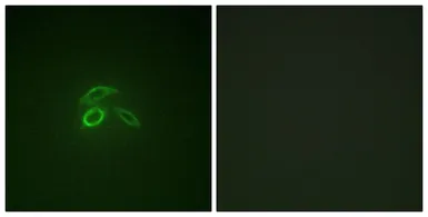 Anti-MUC1 (phospho Tyr1229) antibody used in Immunocytochemistry/ Immunofluorescence (ICC/IF). GTX55325