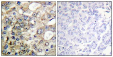 Anti-MUC1 (phospho Tyr1229) antibody used in IHC (Paraffin sections) (IHC-P). GTX55325