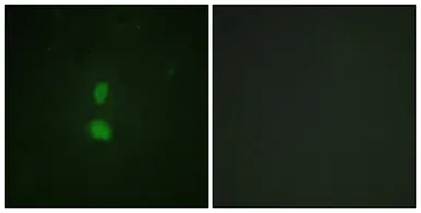 Anti-SNAI1 (phospho Ser246) antibody used in Immunocytochemistry/ Immunofluorescence (ICC/IF). GTX55326