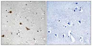Anti-IKK gamma (phospho Ser376) antibody used in IHC (Paraffin sections) (IHC-P). GTX55331