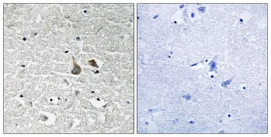 Anti-IRAK1 (phospho Ser376) antibody used in IHC (Paraffin sections) (IHC-P). GTX55332