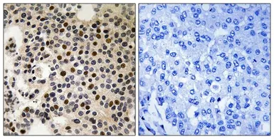 Anti-PAK2 (phospho Ser197) antibody used in IHC (Paraffin sections) (IHC-P). GTX55335
