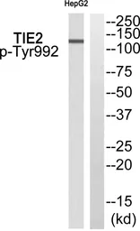 Anti-TIE2 (phospho Tyr992) antibody used in Western Blot (WB). GTX55336