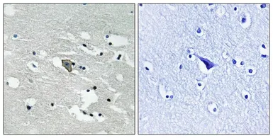 Anti-VEGF Receptor 1 (phospho Tyr1048) antibody used in IHC (Paraffin sections) (IHC-P). GTX55337