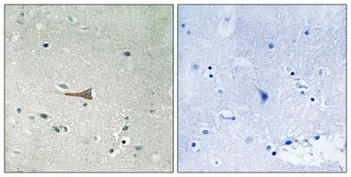 Anti-DDR1 (phospho Tyr513) antibody used in IHC (Paraffin sections) (IHC-P). GTX55341
