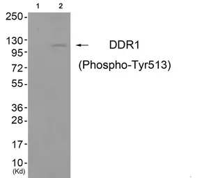 Anti-DDR1 (phospho Tyr513) antibody used in Western Blot (WB). GTX55341