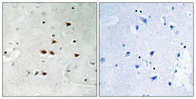 Anti-ITCH (phospho Tyr420) antibody used in IHC (Paraffin sections) (IHC-P). GTX55343