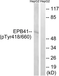 Anti-EPB41 (phospho Tyr660/418) antibody used in Western Blot (WB). GTX55359
