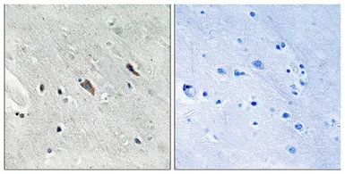 Anti-GAB2 (phospho Tyr643) antibody used in IHC (Paraffin sections) (IHC-P). GTX55361