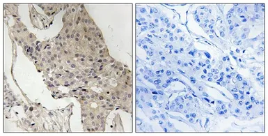 Anti-GAB2 (phospho Ser623) antibody used in IHC (Paraffin sections) (IHC-P). GTX55362