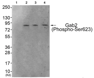 Anti-GAB2 (phospho Ser623) antibody used in Western Blot (WB). GTX55362
