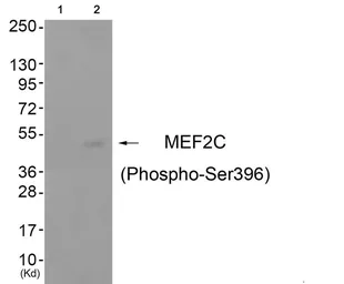 Anti-MEF2C (phospho Ser396) antibody used in Western Blot (WB). GTX55365