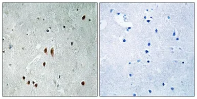 Anti-CNOT2 (phospho Ser101) antibody used in IHC (Paraffin sections) (IHC-P). GTX55366