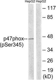 Anti-NCF1 (phospho Ser345) antibody used in Western Blot (WB). GTX55367