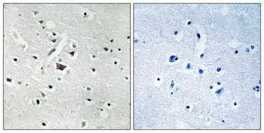 Anti-Phospholipase D2 (phospho Tyr169) antibody used in IHC (Paraffin sections) (IHC-P). GTX55368
